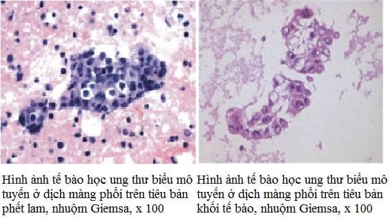 Triển khai kỹ thuật xét nghiệm tế bào học
