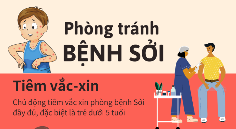 TIÊN DU: TRIỂN KHAI KẾ HOẠCH PHÒNG CHỐNG DỊCH SỞI